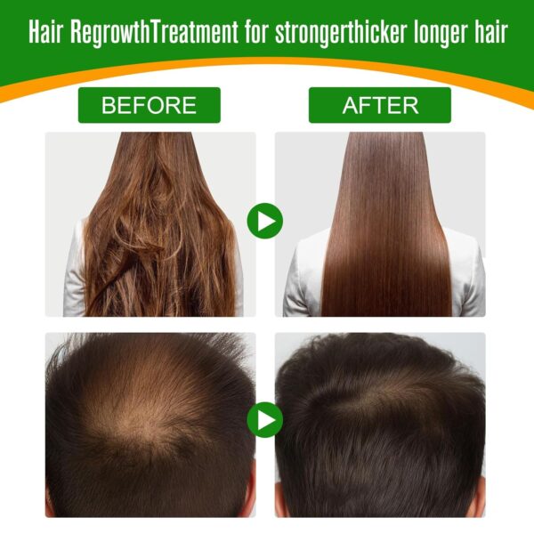 ALIVER Batana Oil for Hair Growth, Batana Oil Organic Cold Press, 100% Natural Batana Hair Oil - Image 7