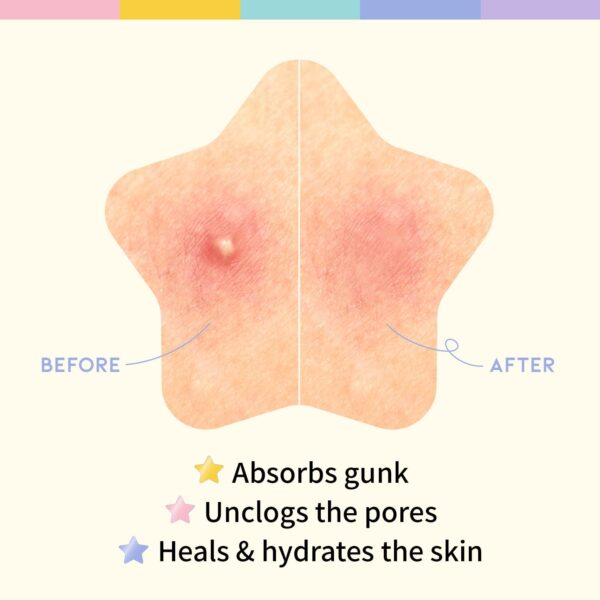 OOTD Star Spot Acne/Pimple Patch For Face, Hydrocolloid, Niacinamide, Ceramide, Cute Pastel Colors,80 count - Image 6