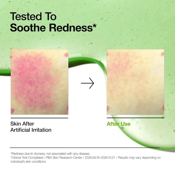 Anua Azelaic Acid 10 Hyaluron Redness Soothing Serum, Facial Serum for Sensitive skin, Hyaluronic Acid, Niacinamide, Spot Care, Natural Color, Vegan, Korean Skincare (30ml/ 1.01 fl oz.) - Image 6