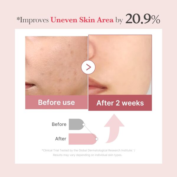 medicube PDRN Pink Collagen Exosome Shot Serum 7,500 PPM | Liquid Skin Booster | Exosome, Salmon DNA PDRN, Spicules | Uneven Skin Tone, Pore Care, Skin Texture | Korean Skin Care 1.01 fl.oz - Image 3