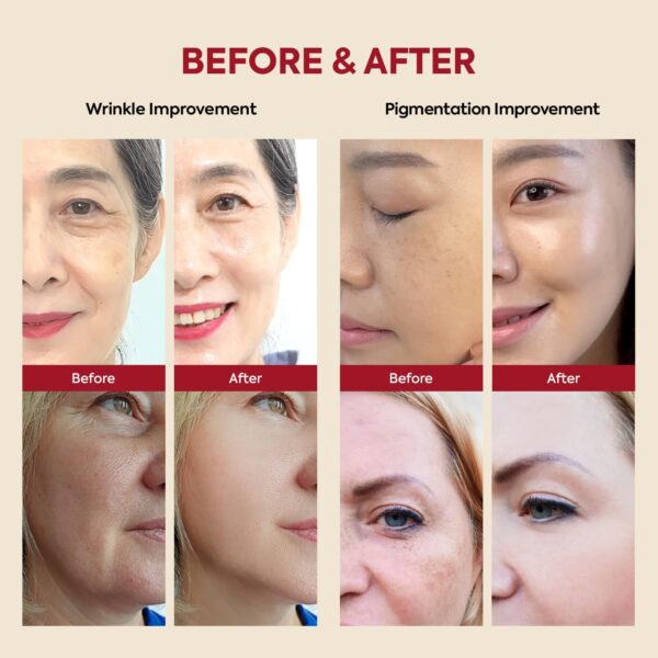 KSECRET SEOUL 1988 Retinal Serum: Retinol Serum for Face Anti Aging Wrinkle Care - 2% Retinal Liposome Black Ginseng Niacinamide Bakuchiol Vitamin C & 3 Peptides - Korean Skincare Fragrance Free 30mL - Image 7