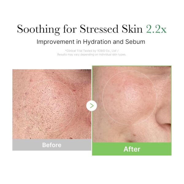 Medicube Exosome Cica Tea Tree Cream for Sensitive Skin with Centella Asiatica help reduce redness and breakouts. | Low-irritating, Moisturizing Daily Texture Care | Korean Skincare | 1.7 fl oz - Image 6