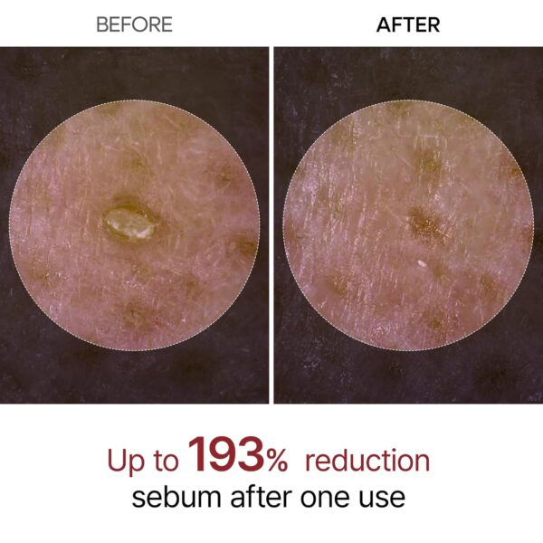 Dr Melaxin Peel Shot Glow Black Rice Peeling Ampoule, Soft Exfoliating Face and Body Scrub Dead Skin Cells, Blackheads Remover for All Skin Types korean skin care 80ml - Image 4