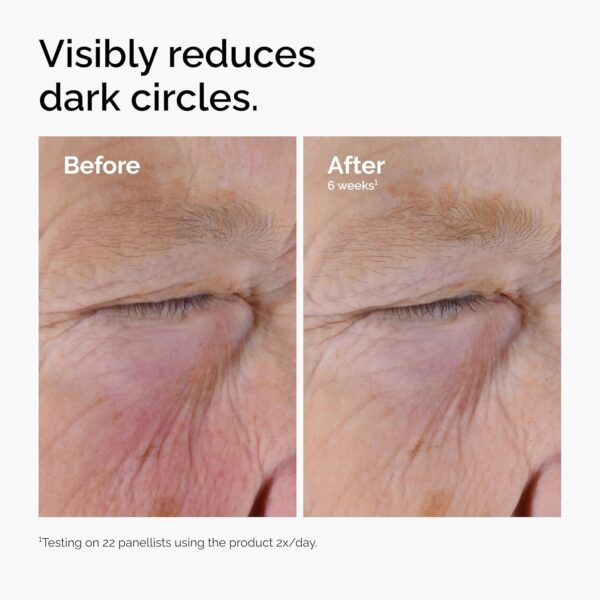 The Ordinary Caffeine Solution 5% + EGCG, Depuffing Eye Serum for Dark Circles and Tired Eyes 1oz - Image 3