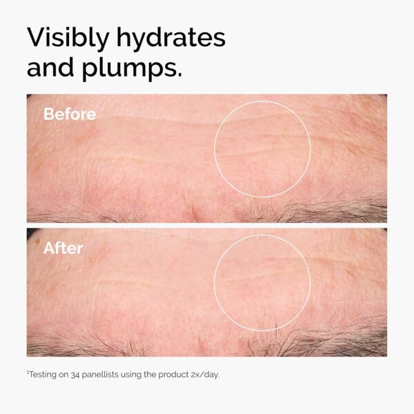 The Ordinary Hyaluronic Acid 2% + B5 (with Ceramides), Multi-Depth Hydration Serum for Plumper, Smoother Skin , 1oz - Image 8