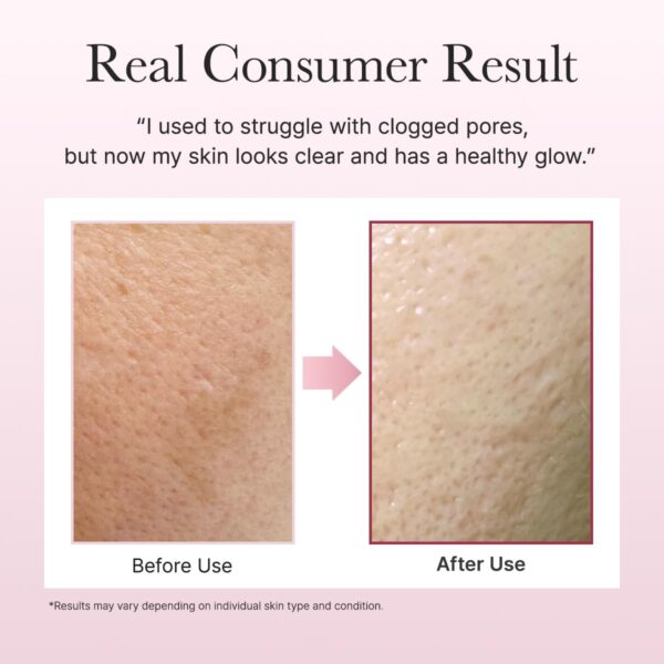 Arencia Fresh Rosehip Rice Mochi Cleanser, 120g - Image 7