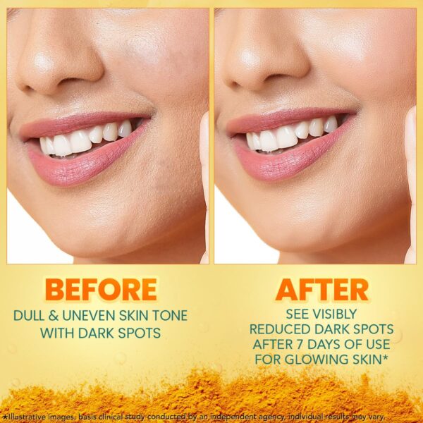 Himalaya Dark Spot Clearing Turmeric Face Serum for glowing skin | with Niacinamide, Glycolic acid & Organically sourced Turmeric | Reduces Dark Spots from Day 7 for Glowing skin | 30ml - Image 8